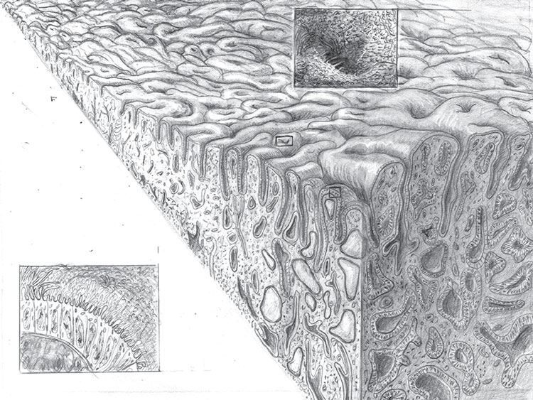 Pathology illustration