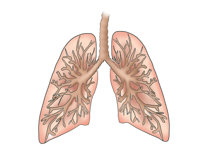 Post-Obstructive Pulmonary Edema
