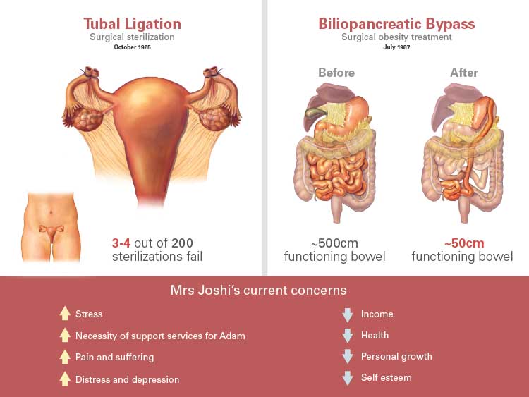 Medical legal illustration board of plaintiff case highlighting complex surgeries